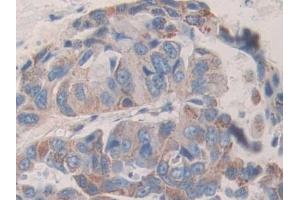 Used in DAB staining on fromalin fixed paraffin- embedded stomach tissue (KIR2DL2 anticorps  (AA 22-348))