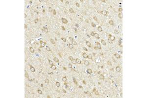 Immunohistochemistry of paraffin-embedded Rat brain using  antibody (ABIN6129864, ABIN6136458, ABIN6136459 and ABIN6222564) at dilution of 1:50 (40x lens).
