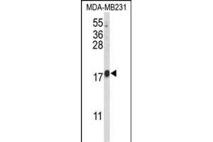 Western blot analysis of HRIHF Antibody (C-term) (ABIN653093 and ABIN2842686) in MDA-M cell line lysates (35 μg/lane). (CBY1/PGEA1 anticorps  (C-Term))