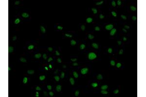 Immunofluorescence analysis of HeLa cells using PLCG2 antibody (ABIN5971208). (Phospholipase C gamma 2 anticorps)
