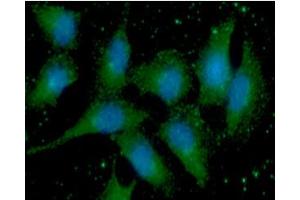 ICC/IF analysis of S100A11 in A549 cells line, stained with DAPI (Blue) for nucleus staining and monoclonal anti-human S100A11 antibody (1:100) with goat anti-mouse IgG-Alexa fluor 488 conjugate (Green).