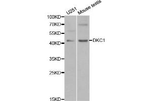 Western blot analysis of extracts of various cell lines, using DKC1 antibody (ABIN5970956) at 1/1000 dilution. (DKC1 anticorps)