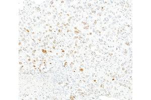 anti-gamma Histone Variant H2AX (GAMMA-H2AX) (Ser140) antibody