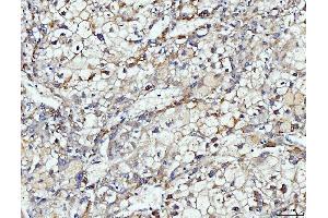 IHC analysis of DUSP6 using anti-DUSP6 antibody (ABIN7599332). (DUSP6 anticorps  (AA 1-381))