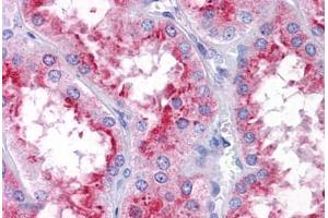 Human Kidney: Formalin-Fixed, Paraffin-Embedded (FFPE) (PICALM anticorps  (N-Term))