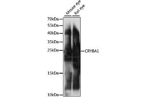 Western blot analysis of extracts of various cell lines, using CRYBA1 antibody (ABIN6291831) at 1:1000 dilution.