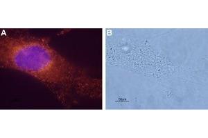 Expression of Bombesin receptor 1 in a human breast cancer cell line - Immunocytochemical staining of paraformaldehyde-fixed and permeabilized mammary gland adenocarcinoma MDA-MB-231.