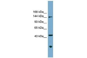 WB Suggested Anti-ERCC6L Antibody Titration: 0. (ERCC6L anticorps  (N-Term))