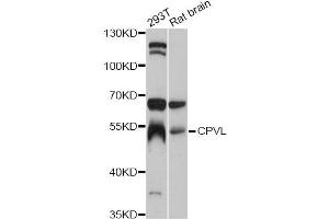 Western blot analysis of extracts of various cell lines, using CPVL antibody (ABIN5997512) at 1:3000 dilution. (CPVL anticorps)