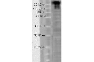 Image no. 1 for anti-Sodium Channel, Voltage-Gated, Type IX, alpha Subunit (SCN9A) (AA 1751-1946) antibody (ABIN466986) (SCN9A anticorps  (AA 1751-1946))