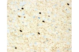 IHC-P: Calretinin antibody testing of mouse brain tissue (Calretinin anticorps  (C-Term))
