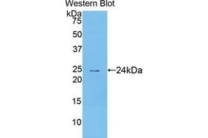 Detection of Recombinant TECK, Human using Polyclonal Antibody to Thymus Expressed Chemokine (TECK)
