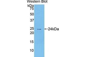 Detection of Recombinant TECK, Human using Polyclonal Antibody to Thymus Expressed Chemokine (TECK) (CCL25 anticorps  (AA 24-150))