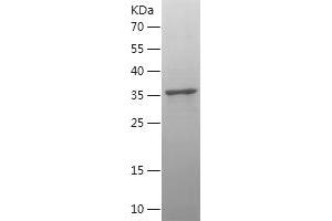 Western Blotting (WB) image for Cytochrome C Oxidase Subunit II (COX2) (AA 104-209) protein (His-IF2DI Tag) (ABIN7122571)