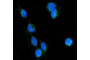 anti-Ras Homolog Gene Family, Member B (RHOB) antibody