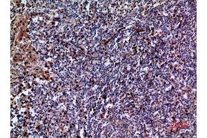 Immunohistochemistry (IHC) analysis of paraffin-embedded Human Tonsil, antibody was diluted at 1:100.