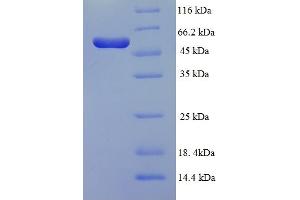SDS-PAGE (SDS) image for Nuclear Receptor Subfamily 1, Group I, Member 3 (NR1I3) (AA 2-351), (partial) protein (His-SUMO Tag) (ABIN5711315)