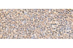 Immunohistochemistry of paraffin-embedded Human tonsil tissue using IQCD Polyclonal Antibody at dilution of 1:60(x200)