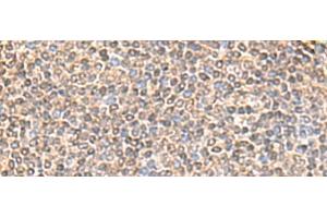 Immunohistochemistry of paraffin-embedded Human tonsil tissue using IQCD Polyclonal Antibody at dilution of 1:60(x200) (IQCD anticorps)