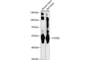 Western blot analysis of extracts of various cell lines, using C antibody (ABIN7266047) at 1:1000 dilution. (CASQ2 anticorps  (AA 20-399))