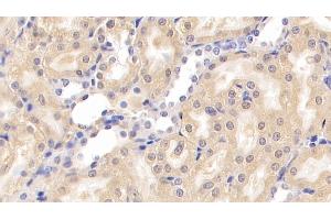 Detection of NPHN in Rat Kidney Tissue using Monoclonal Antibody to Nephrin (NPHN) (Nephrin anticorps  (AA 39-106))