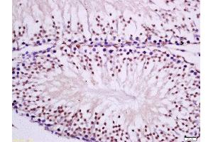 Formalin-fixed and paraffin embedded rat testis tissue labeled with Anti-PKC epsilon Polyclonal Antibody, Unconjugated 1:300 followed by conjugation to the secondary antibody and DAB staining.