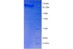 Tyrosyl-tRNA Synthetase (Yars) (AA 2-528), (full length) protein (GST tag)