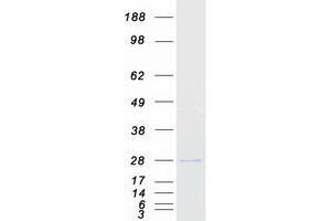 Validation with Western Blot
