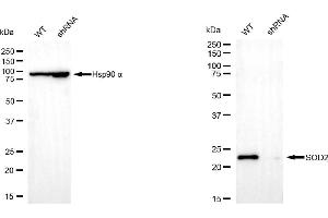 Western blotting analysis using superoxide dismutase 2 antibody (ABIN7800462). (SOD2 anticorps)