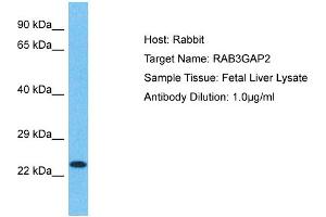 Host: Rabbit Target Name: RAB3GAP2 Sample Type: Fetal Liver lysates Antibody Dilution: 1. (RAB3GAP2 anticorps  (Middle Region))