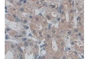 DAB staining on IHC-P; Samples: Human Stomach Tissue