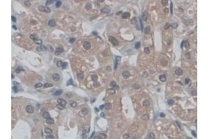 DAB staining on IHC-P; Samples: Human Stomach Tissue (POMT1 anticorps  (AA 318-513))
