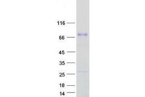 Validation with Western Blot