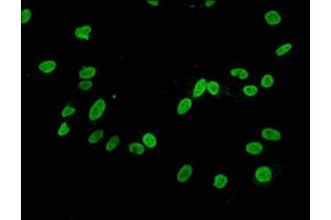 Immunofluorescence staining of Hela cells with ABIN7127289 at 1:34,counter-stained with DAPI. (Recombinant HIST1H3A anticorps  (H3K4me2))
