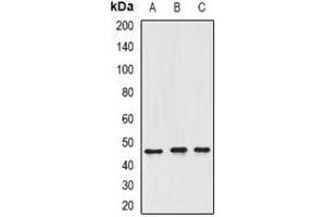 Western blot analysis of ING3 expression in SW620 (A), Hela (B), rat testis (C) whole cell lysates. (ING3 anticorps)