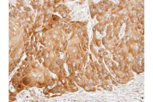 IHC-P Image Immunohistochemical analysis of paraffin-embedded SCC15 xenograft, using VDP/p115, antibody at 1:100 dilution. (USO1 anticorps  (C-Term))