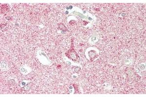 Detection of OSMR in Human Cerebrum Tissue using Polyclonal Antibody to Oncostatin M Receptor (OSMR)