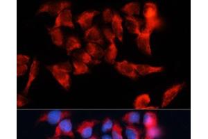 Immunofluorescence analysis of HeLa cells using BST2 Polyclonal Antibody at dilution of 1:100. (BST2 anticorps)