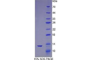 SDS-PAGE analysis of Mouse Nephrin Protein.