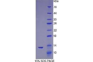 SDS-PAGE analysis of Mouse Nephrin Protein. (Nephrin Protéine)
