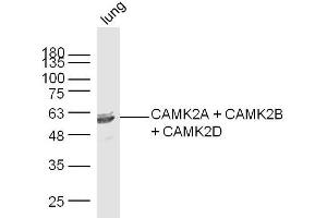Mouse lung lysates probed with CAMK2A + CAMK2B + CAMK2D Polyclonal Antibody, Unconjugated  at 1:300 dilution and 4˚C overnight incubation.