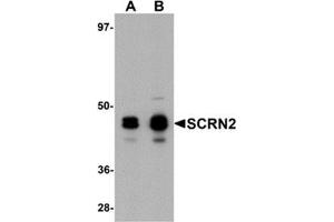 Western blot analysis of SCRN2 in 293 cell tissue lysate with SCRN2 antibody at (A) 0.