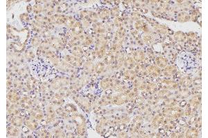 ABIN6269280 at 1/100 staining Mouse kidney tissue by IHC-P. (BMX anticorps  (C-Term))
