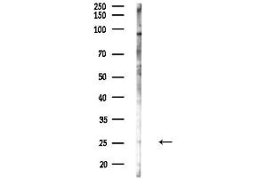 anti-Chemokine (C-X-C Motif) Ligand 2 (CXCL2) (C-Term) antibody