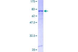 Image no. 1 for Aldehyde Dehydrogenase 3 Family, Member A1 (ALDH3A1) (AA 1-453) protein (GST tag) (ABIN1344830)
