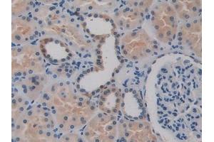 Detection of BGN in Human Kidney Tissue using Polyclonal Antibody to Biglycan (BGN)