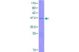 Image no. 1 for Glycine N-Acyltransferase (GLYAT) (AA 1-163) protein (GST tag) (ABIN1355267)