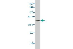 Western Blot detection against Immunogen (35. (LHX6 anticorps  (AA 274-363))