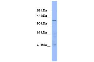 WB Suggested Anti-ARHGAP20 Antibody Titration: 0. (ARHGAP20 anticorps  (Middle Region))