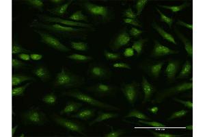 Immunofluorescence of monoclonal antibody to MTA1 on HeLa cell.